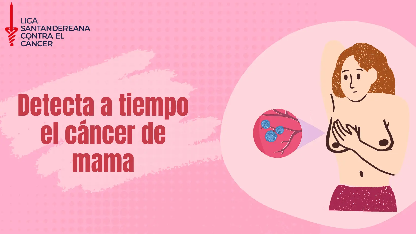 Infografía sobre Cáncer de mama